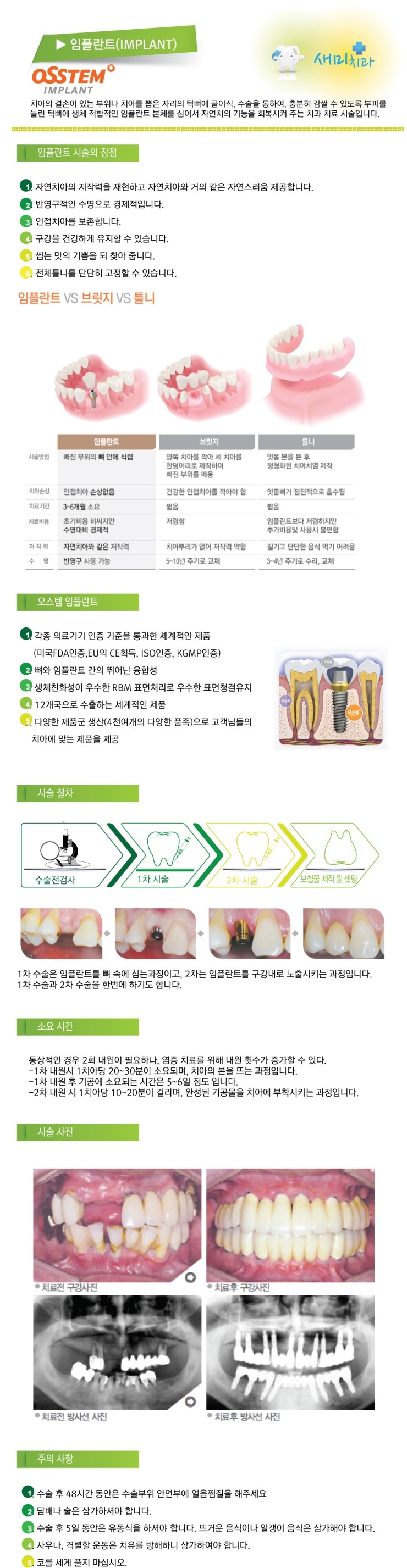saemi-dental-implants